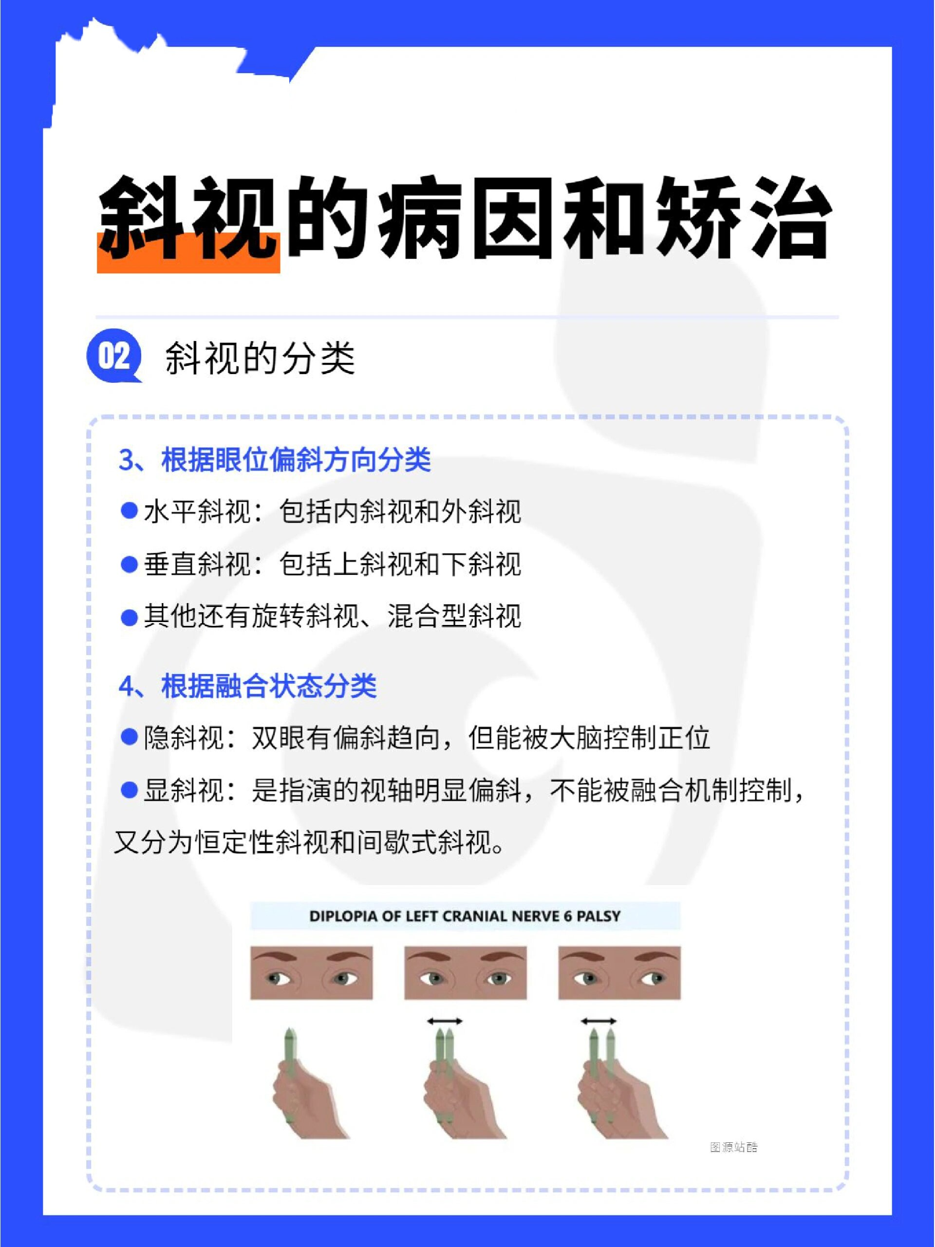 斜视怎么矫治?儿童斜视如何预防? 🔴什么是斜视?