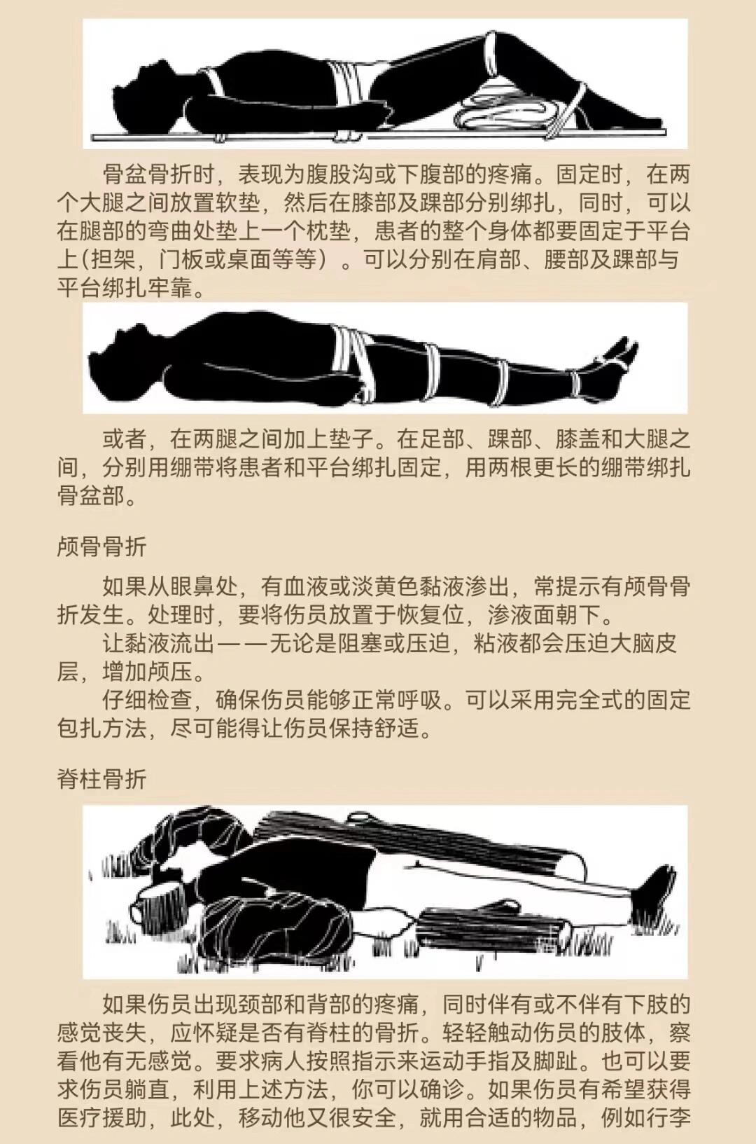 急救技能:骨折的固定