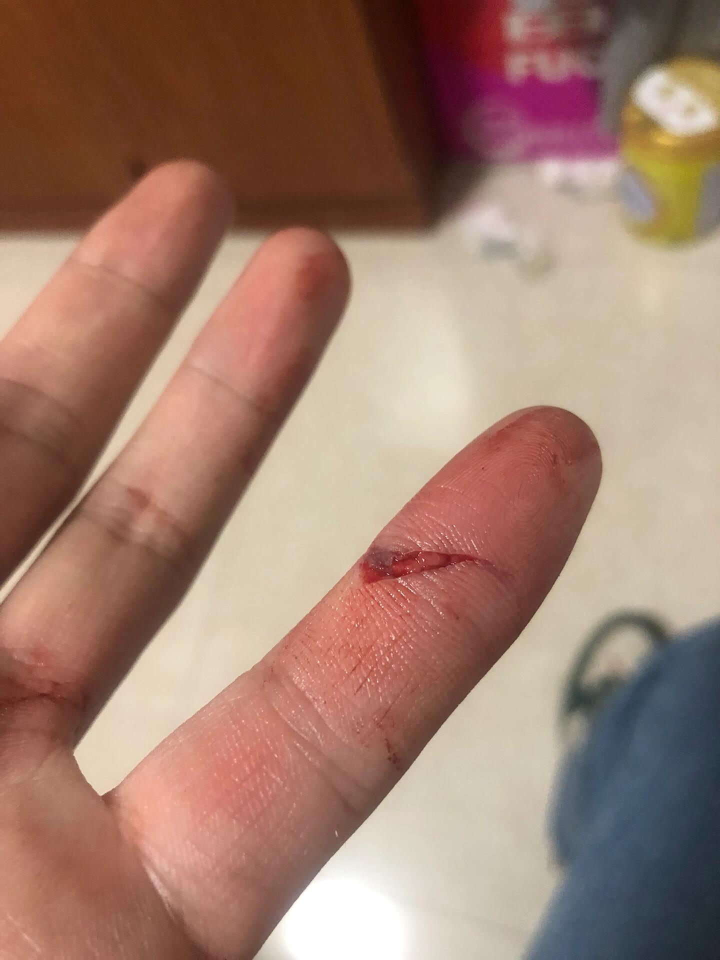 手指划破 很痛,但是不说