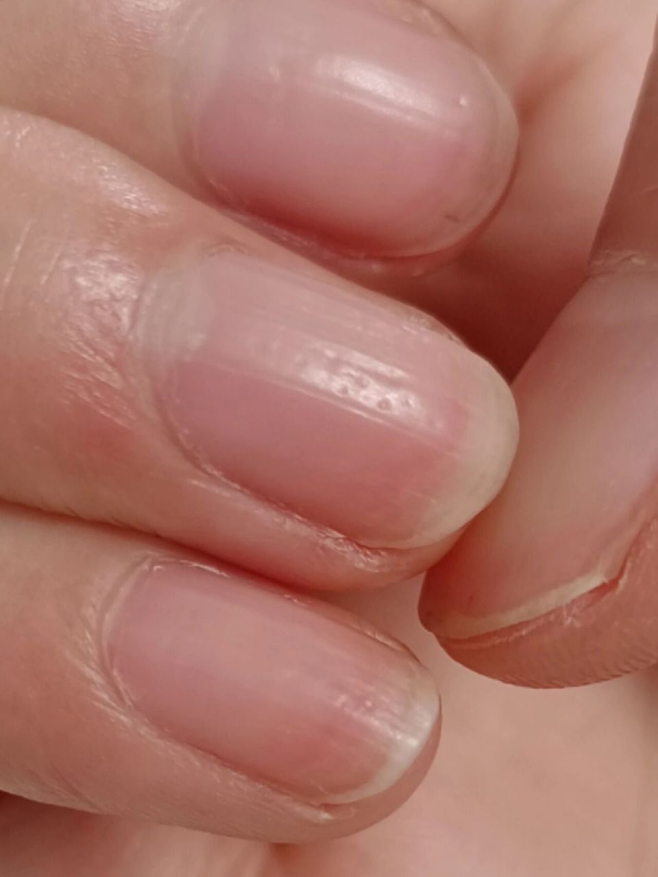 指甲上面有横沟是怎么回事呀 有没有哪位姐妹知道指甲上面的横沟和