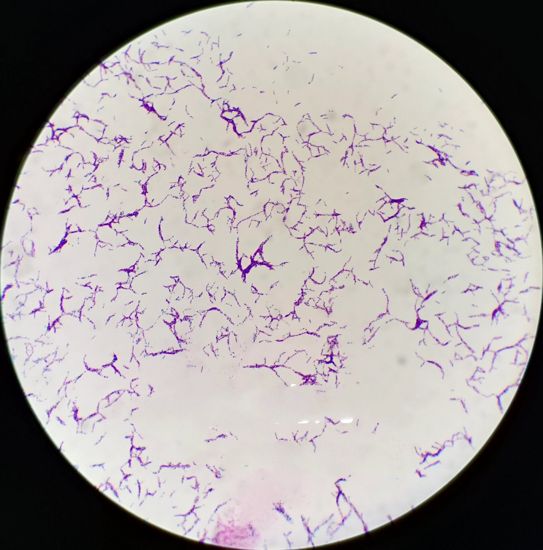 脓肿分枝杆菌 肺泡灌洗液培养,血平板,巧克力平板和中国蓝平板均生长.