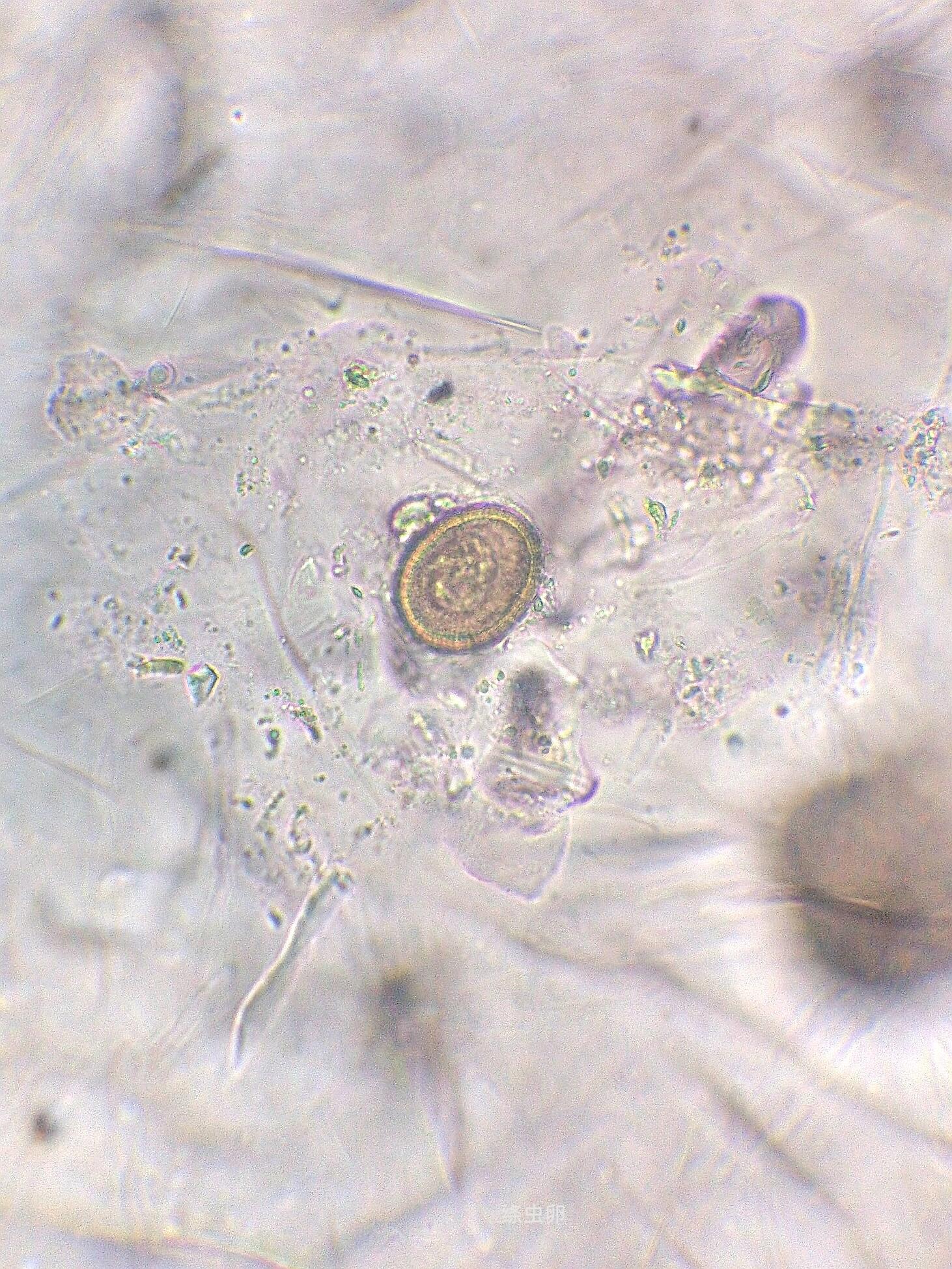 绦虫虫卵形态图片