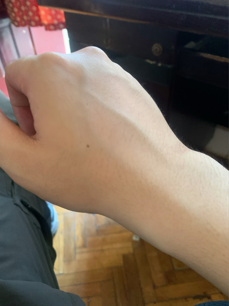 听说右手长痣是上辈子辜负了爱你的人 难怪这辈子不管付出多少努力 到