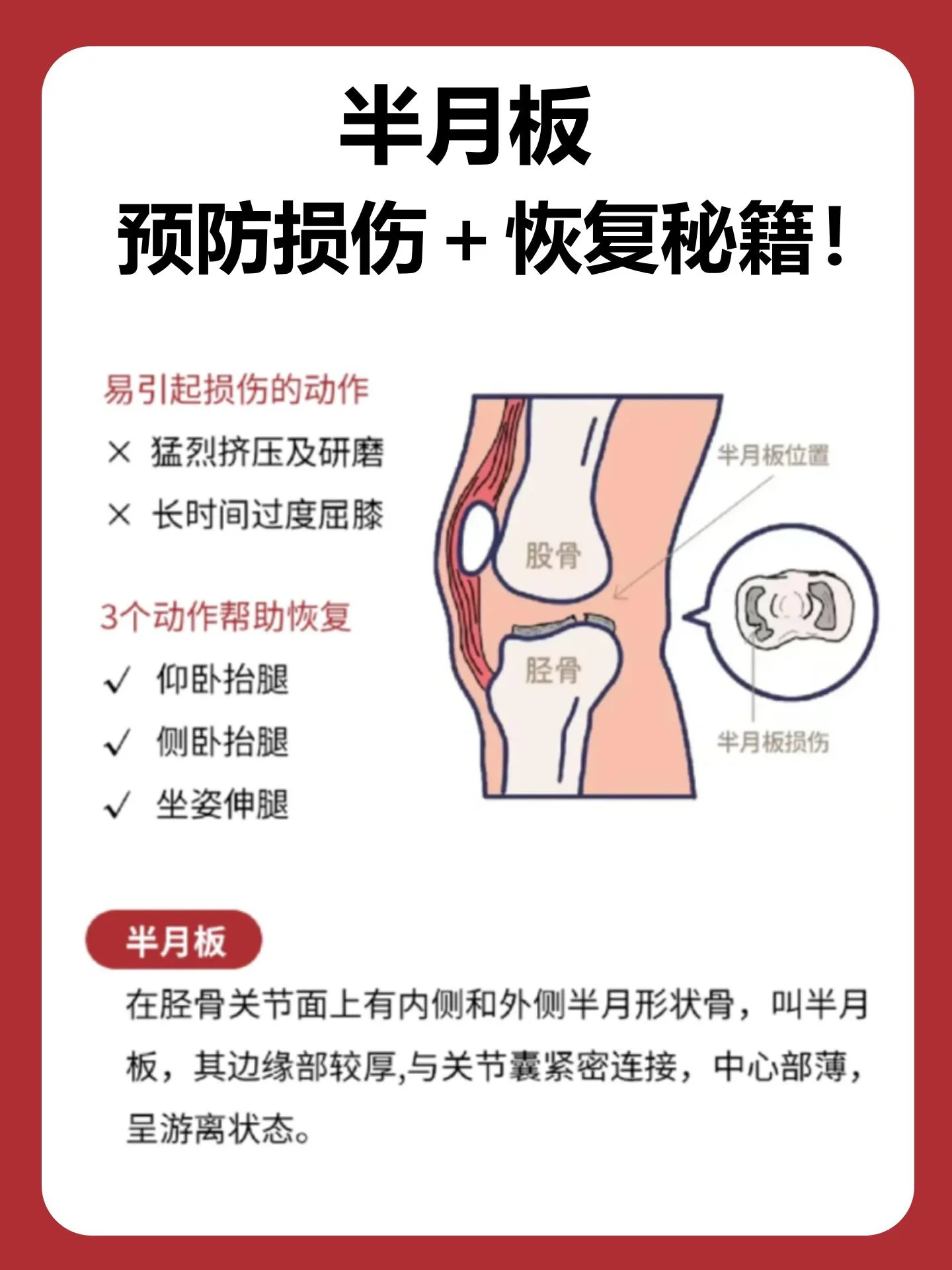 今天给大家分享关于半月板损伤小知识�