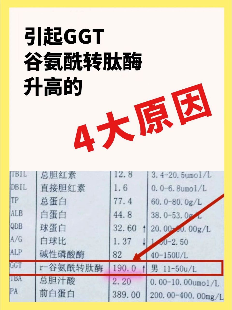 带你解读肝功能化验单——谷氨酰转肽酶 肝功能中有一个比较常见也是