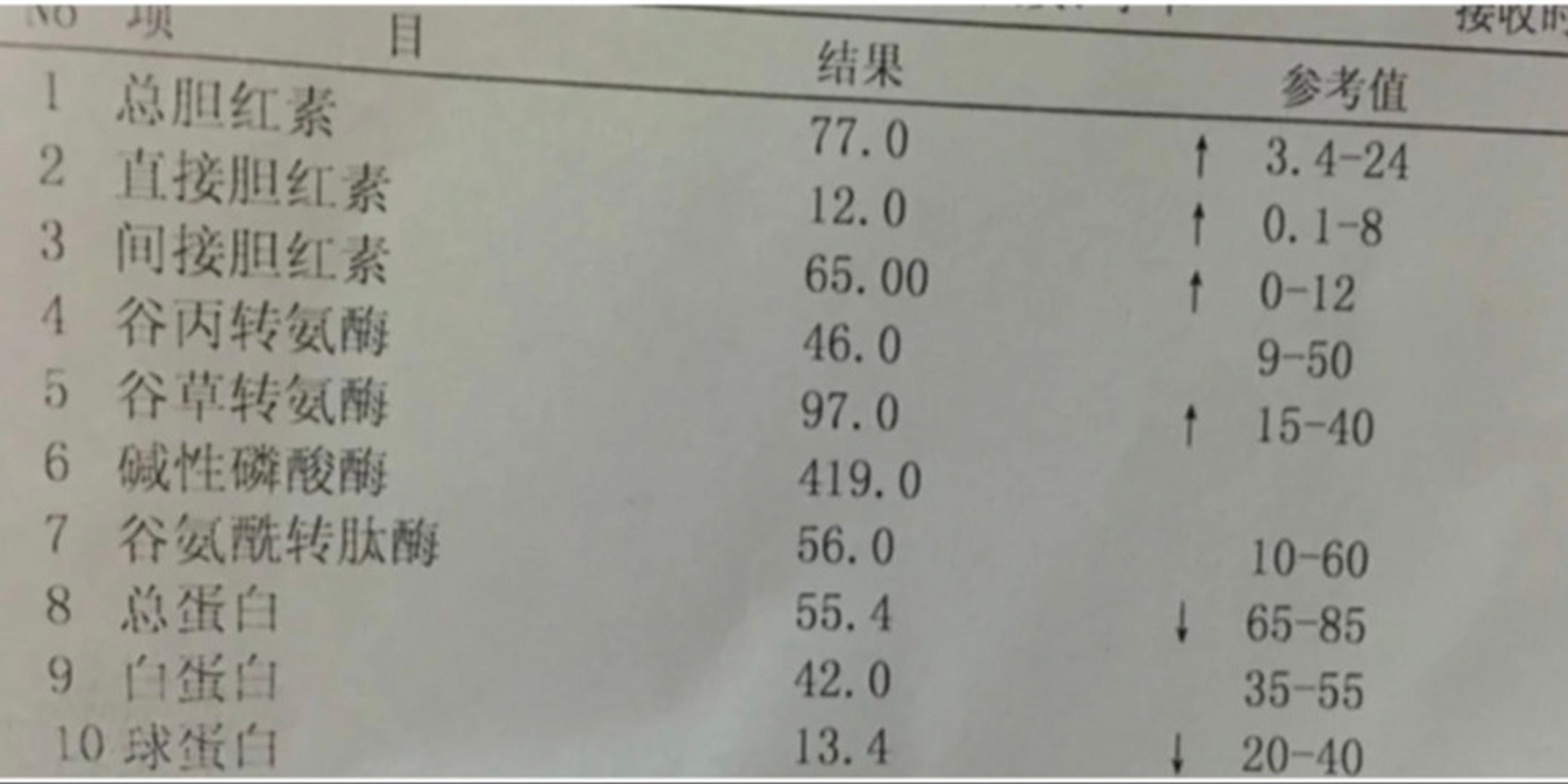 转氨酶正常值图片