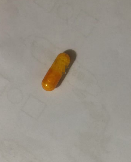 脚后跟脂肪垫炎怎么回事怎么办?