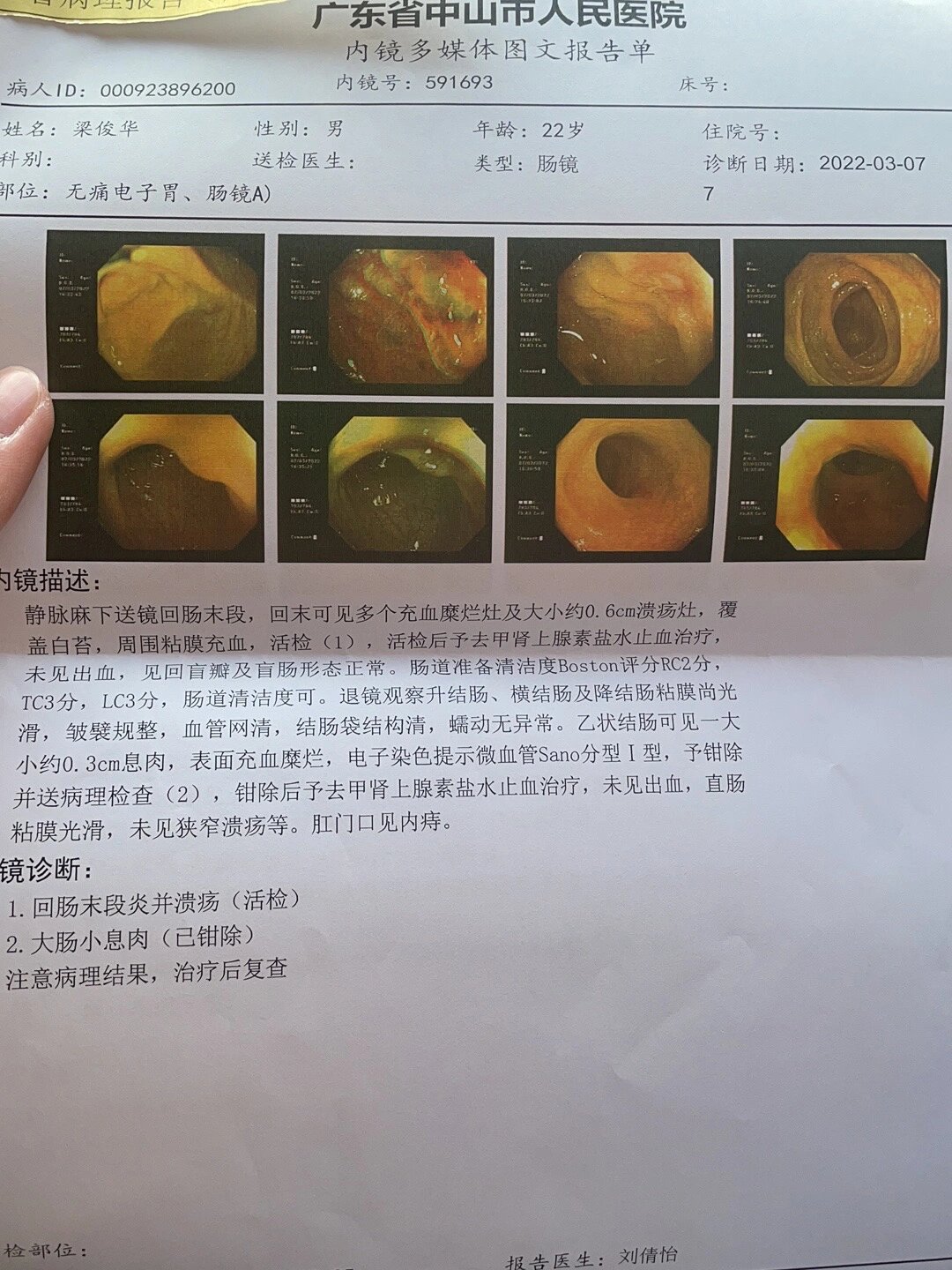 粘膜呈地毯样绒毛状回盲瓣粘膜充血糜烂病理什么样升结肠散在糜烂灶