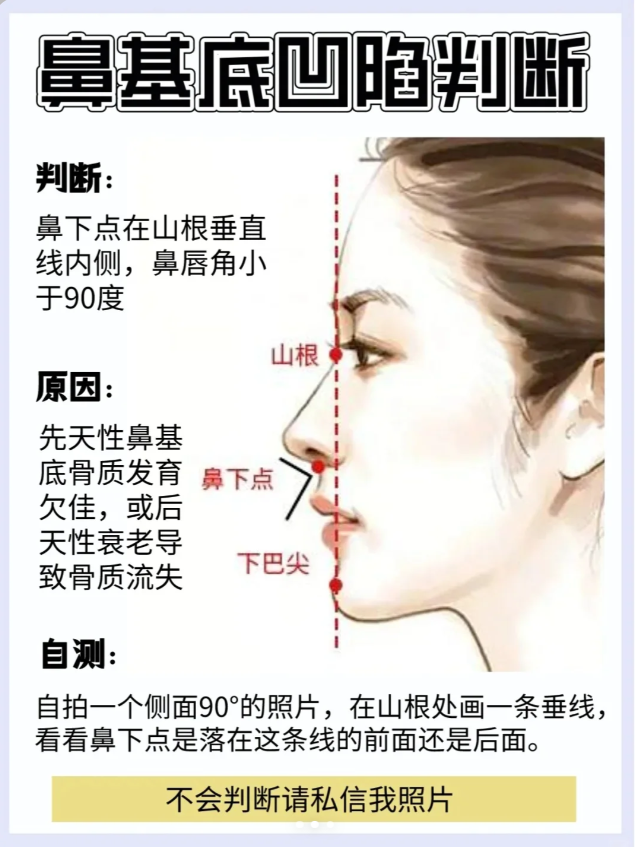 鼻梁高低判断图图片