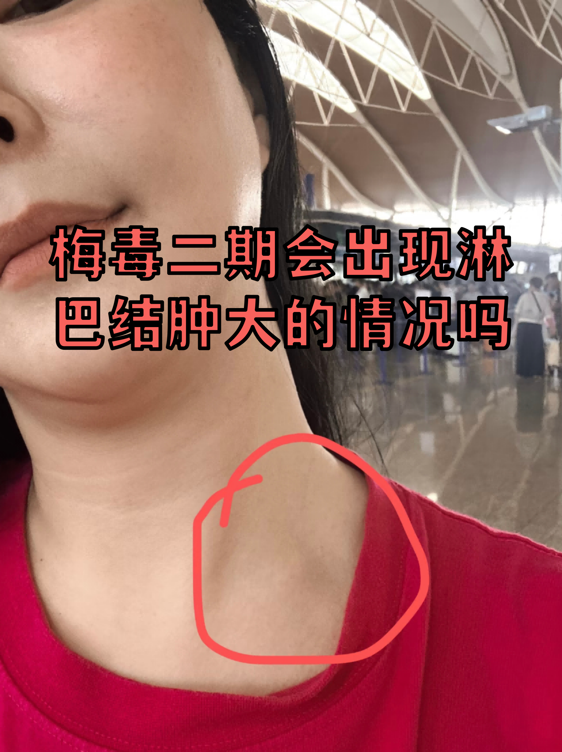  如果的疫情身体会发生什么(如果得疫情身体会发生什么)