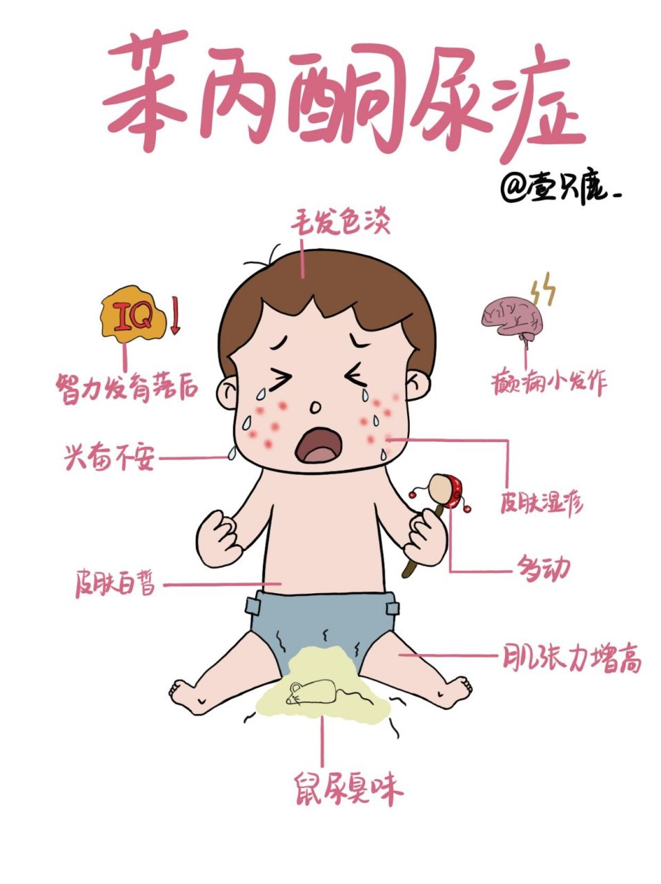 医学生笔记94|苯丙酮尿症02 苯丙酮尿症是一种常染色体隐性遗传