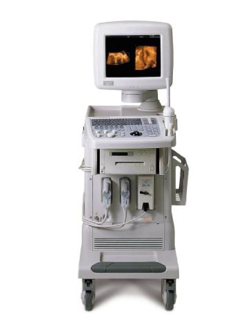 浅谈一下做肛超的体验 今天第一次做妇科肛超检查,原因是上次做腹超不