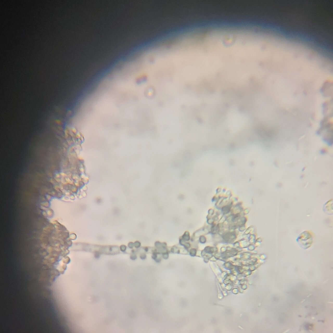 显微观察青霉菌 青霉菌长得好像一串串葡萄99