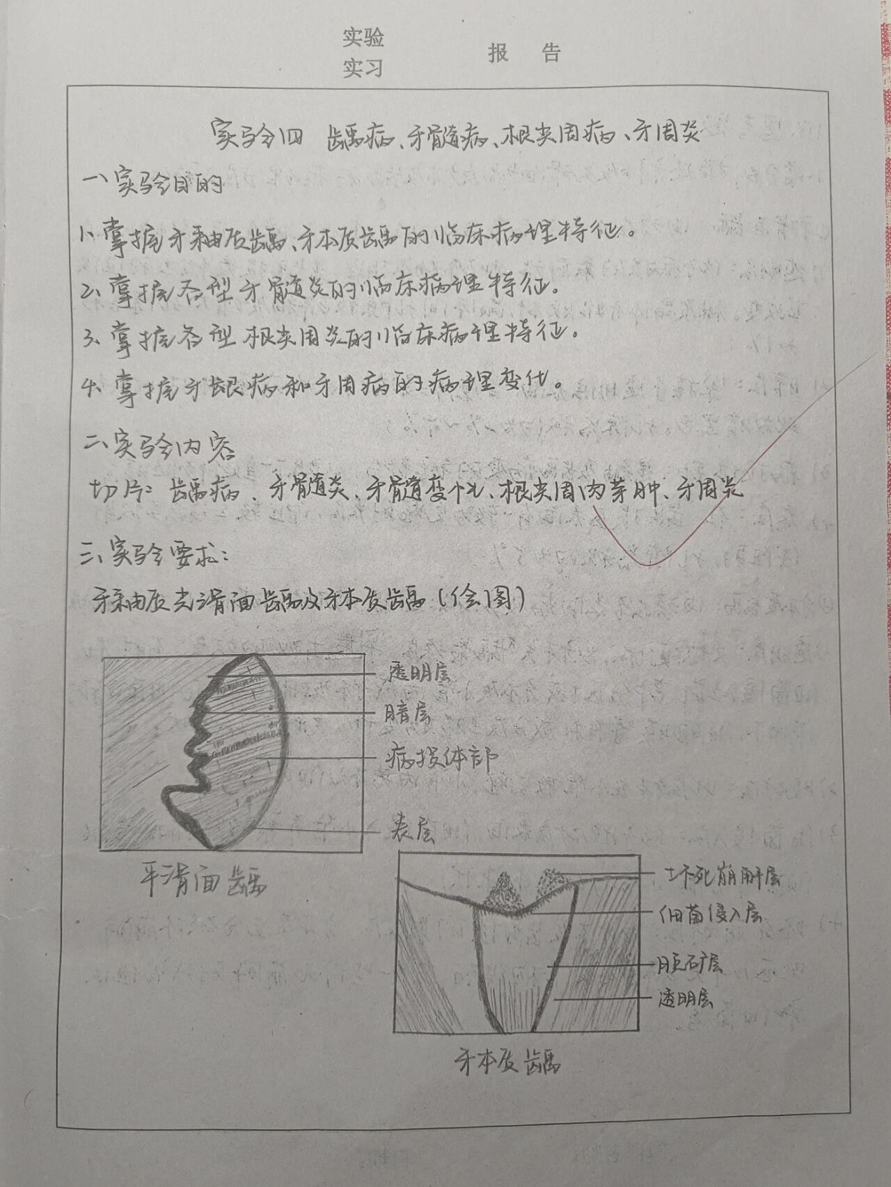 牙釉质红蓝铅笔图图片