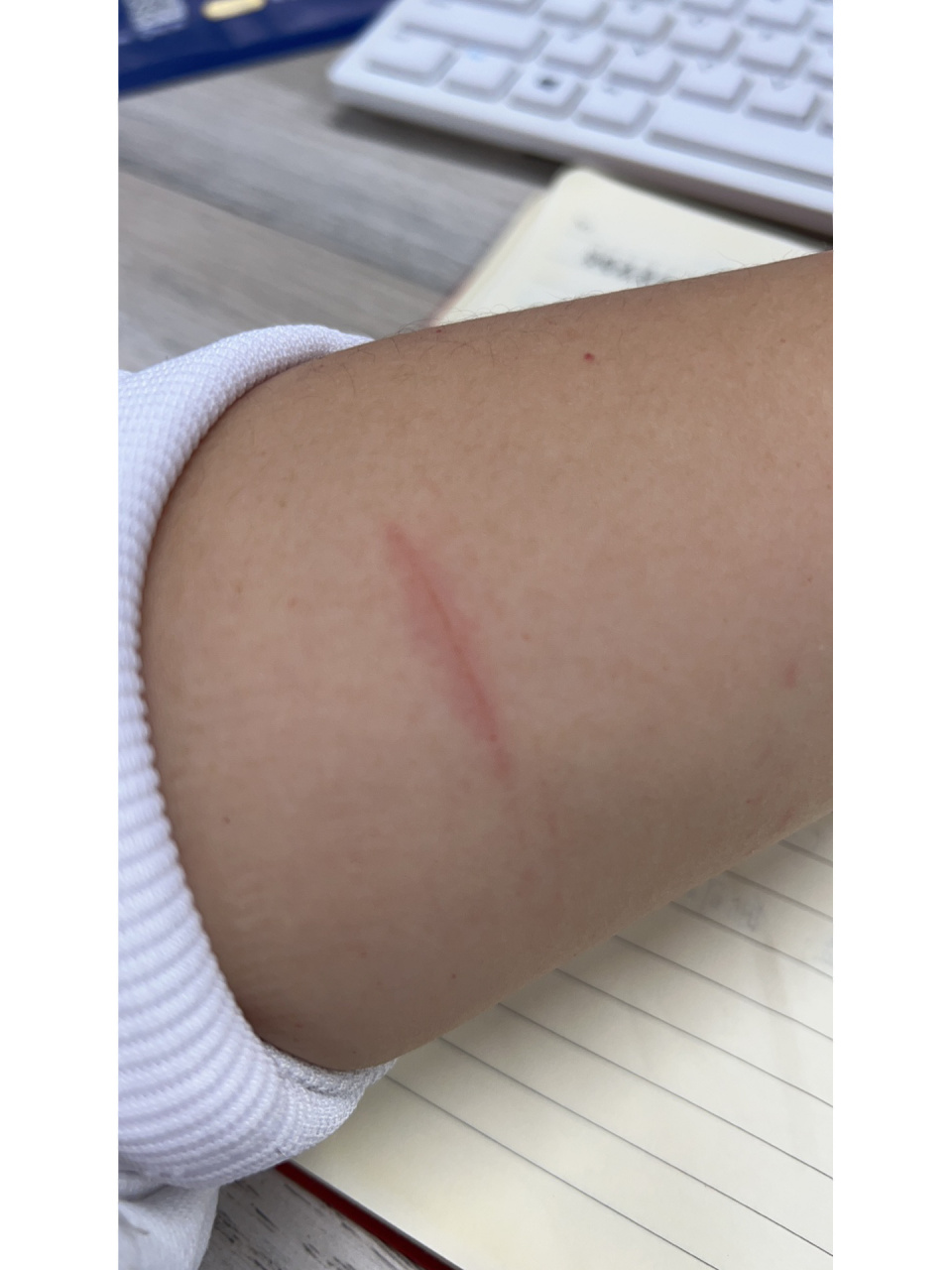 这个是小狗的抓痕么?感觉小狗的指甲不是很