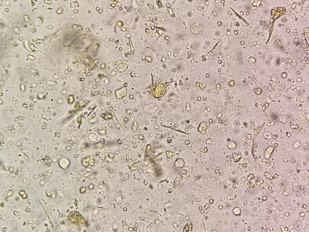 人芽囊原虫 1.常见的人与动物肠道寄生虫 2.