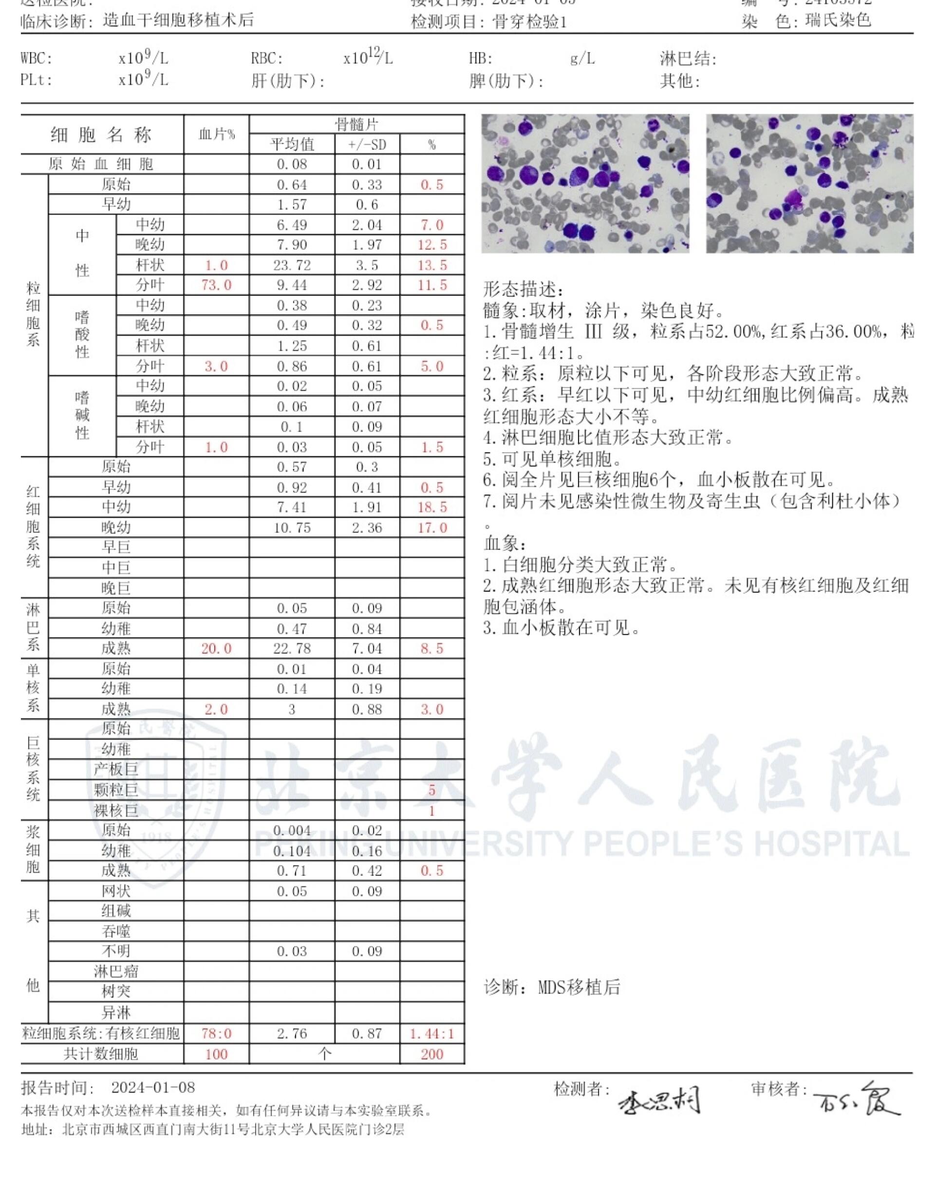 女性染色体报告图片