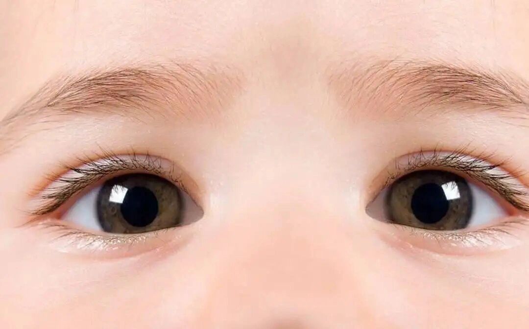 怎样的眼白颜色才是正常的? 眼白,医学上叫做巩膜