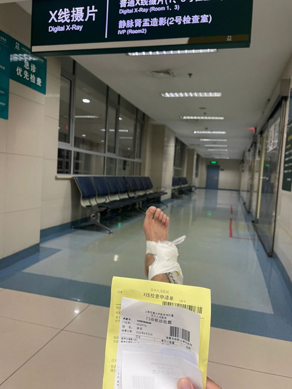 脚腕严重扭伤第三天,还肿的跟馒头一样 前天晚上踢球,右脚射门的一