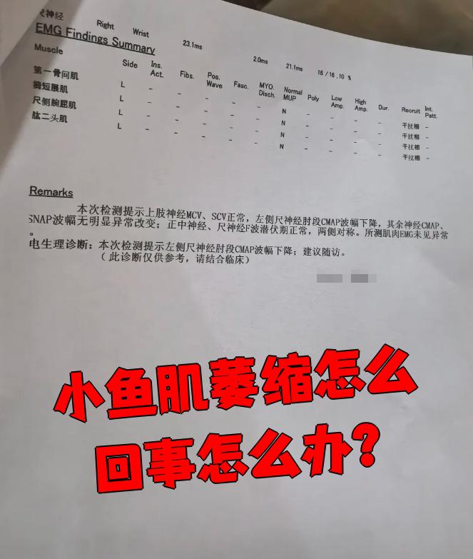 小鱼际萎缩通常是因为小鱼际部位的肌肉失去了神经的营养供应