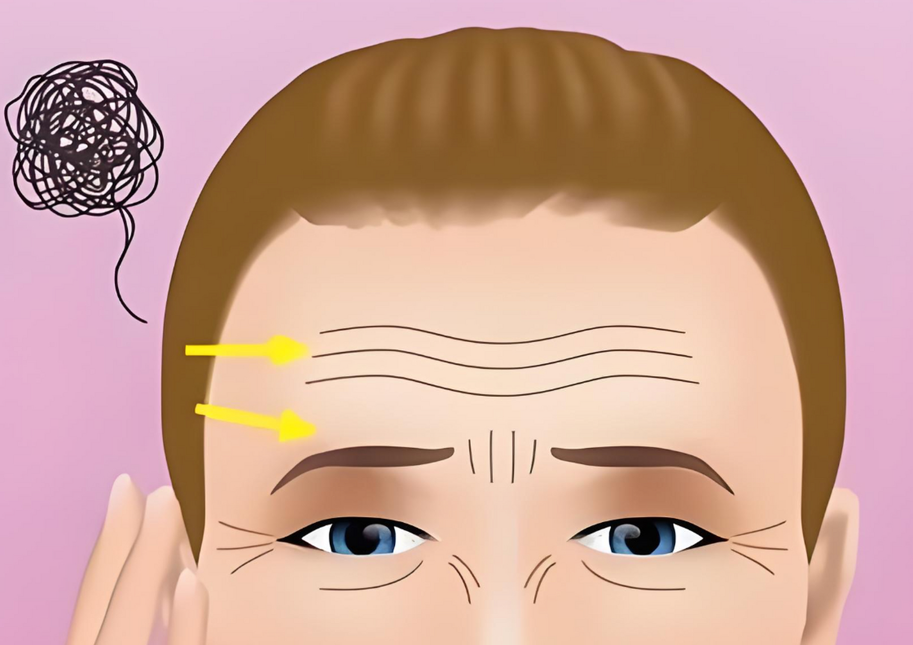 比如说抬头纹,当我们向上抬头时出现的皱纹;还有眉间纹,就是两眉之间