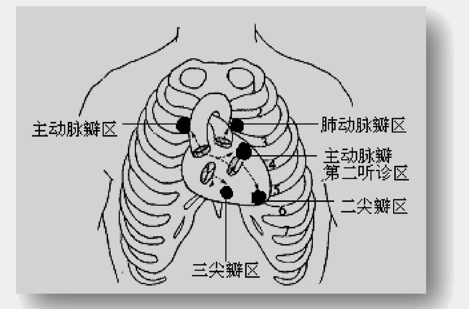 心尖搏动图片