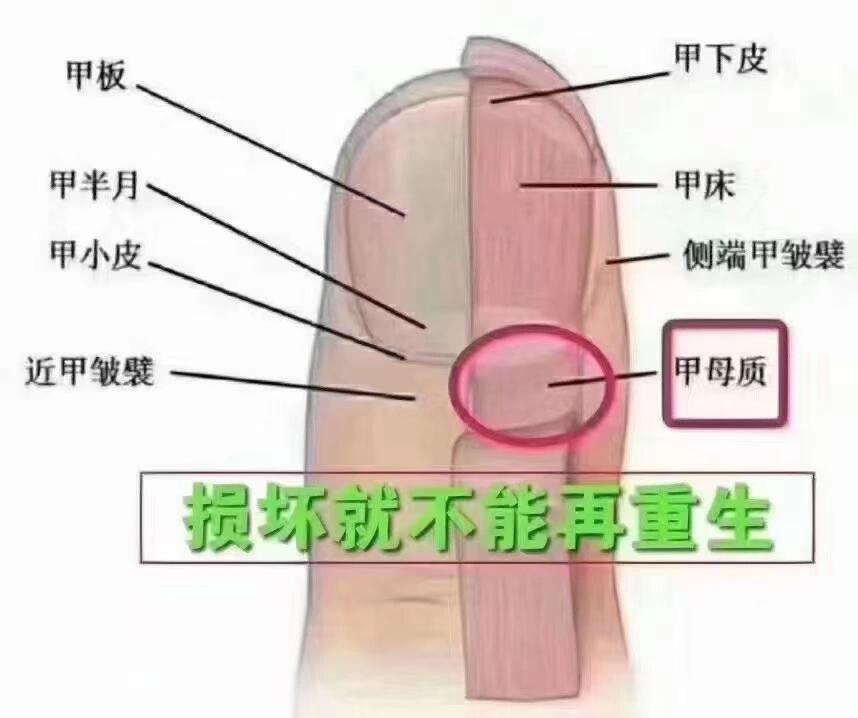 指甲的甲母示意图图片