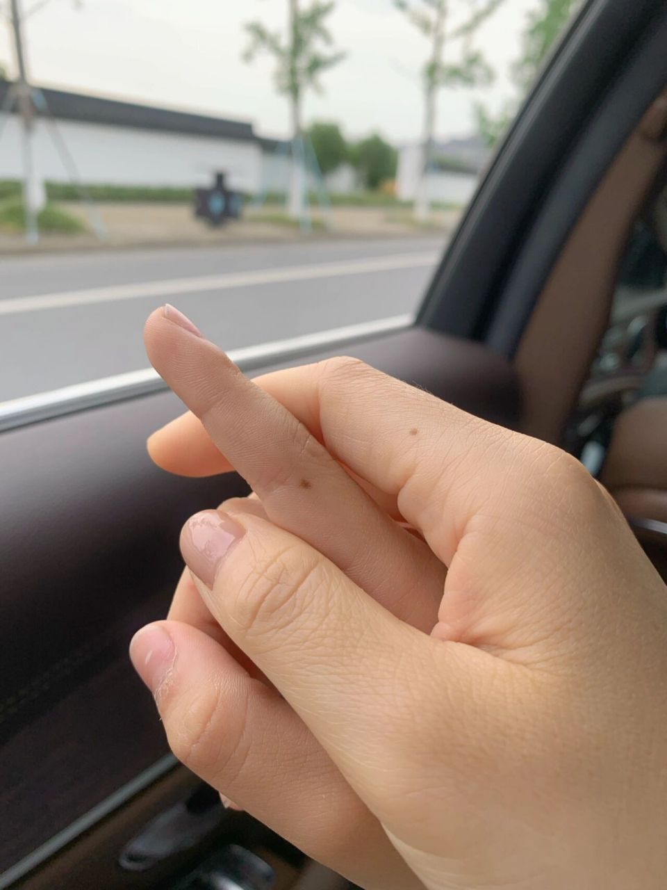 食指长痣女人图片