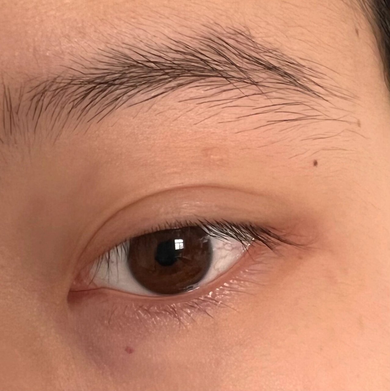 眼睛下面突然长了小红点 什么意思哇摸了摸擦不掉 跟我前两天熬夜有