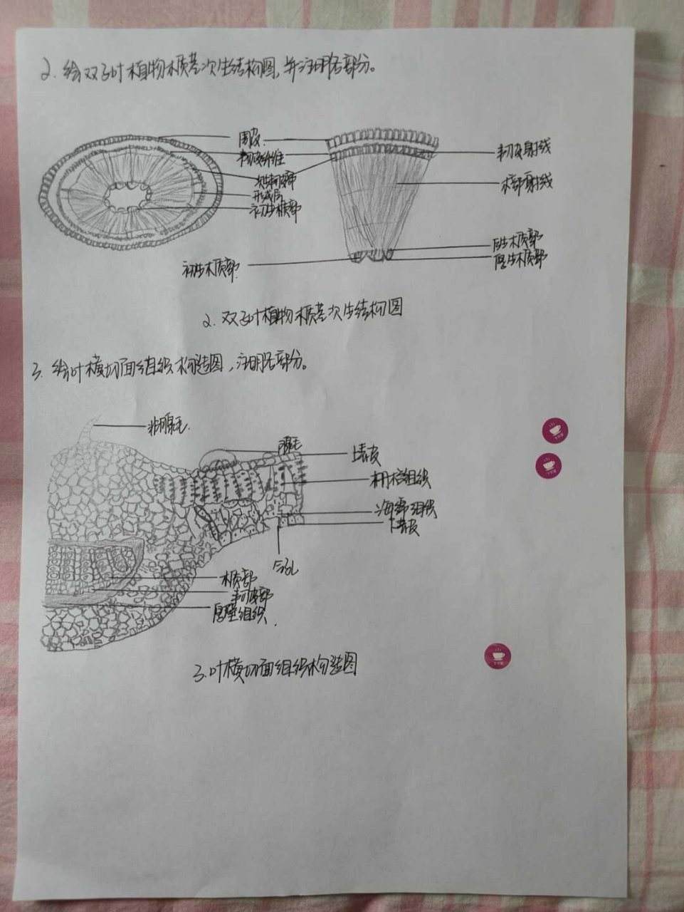 植物根的次生结构简图图片