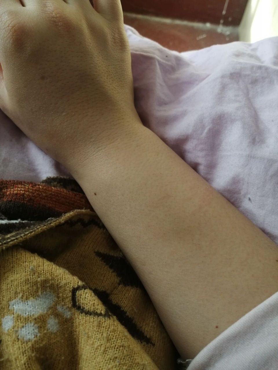 两只手臂上都这样鼓起来了是啥毛病呀