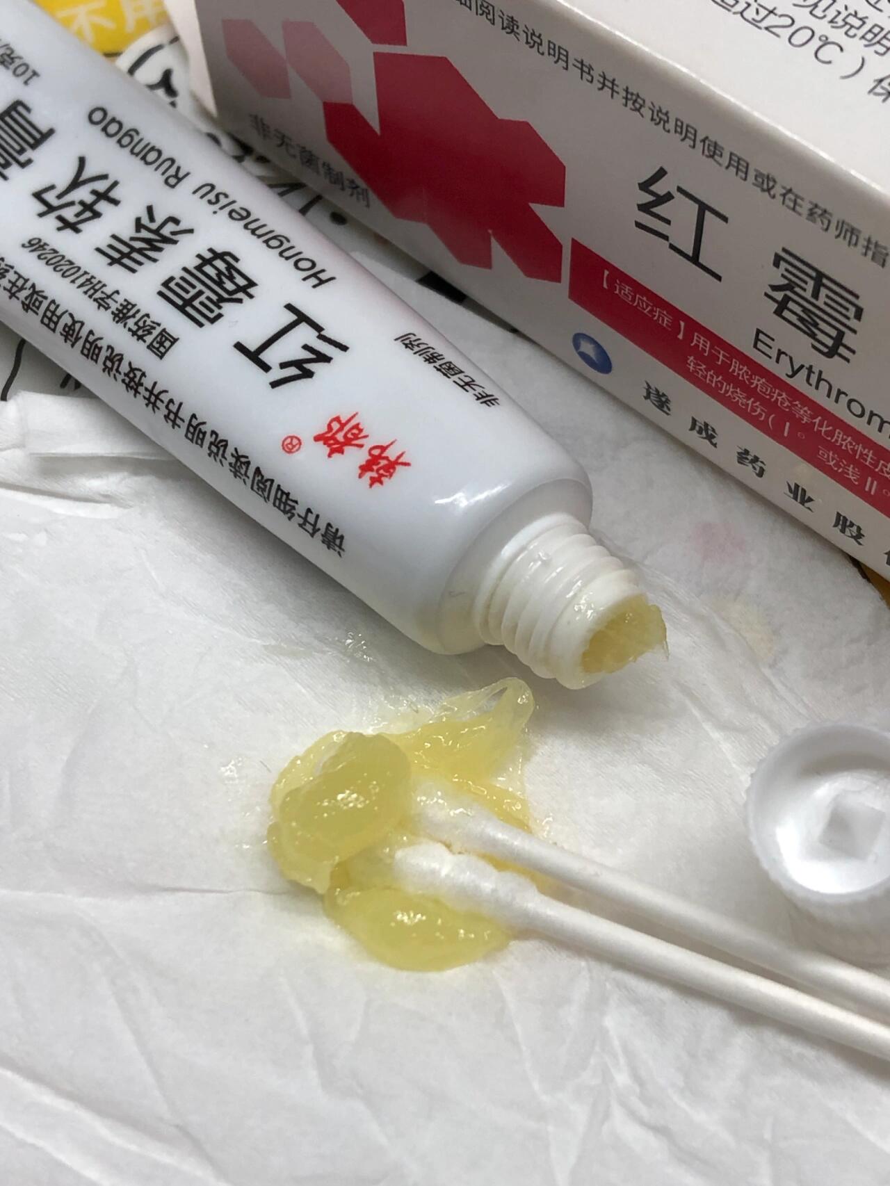 用唇膏得唇炎(唇膏用多了得唇炎) 用唇膏得唇炎(唇膏用多了得唇炎)