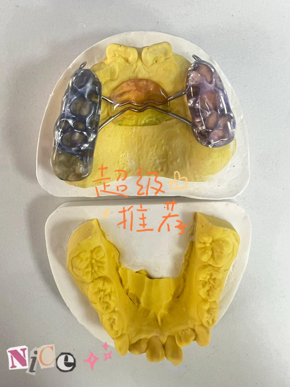 前方牵引分为口内装置,口外面具和橡皮圈几部分.