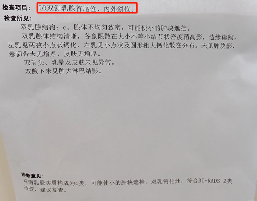 乳腺钼靶检查结果分为i到iv级,其中iii级和iv级需要警惕癌症可能
