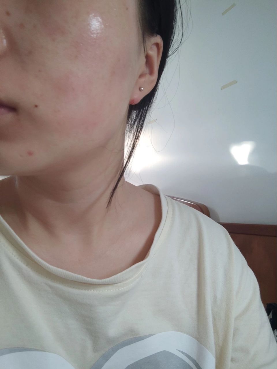 抹了珀莱雅双抗脸泛红发痒 有同样情况的姐妹吗?