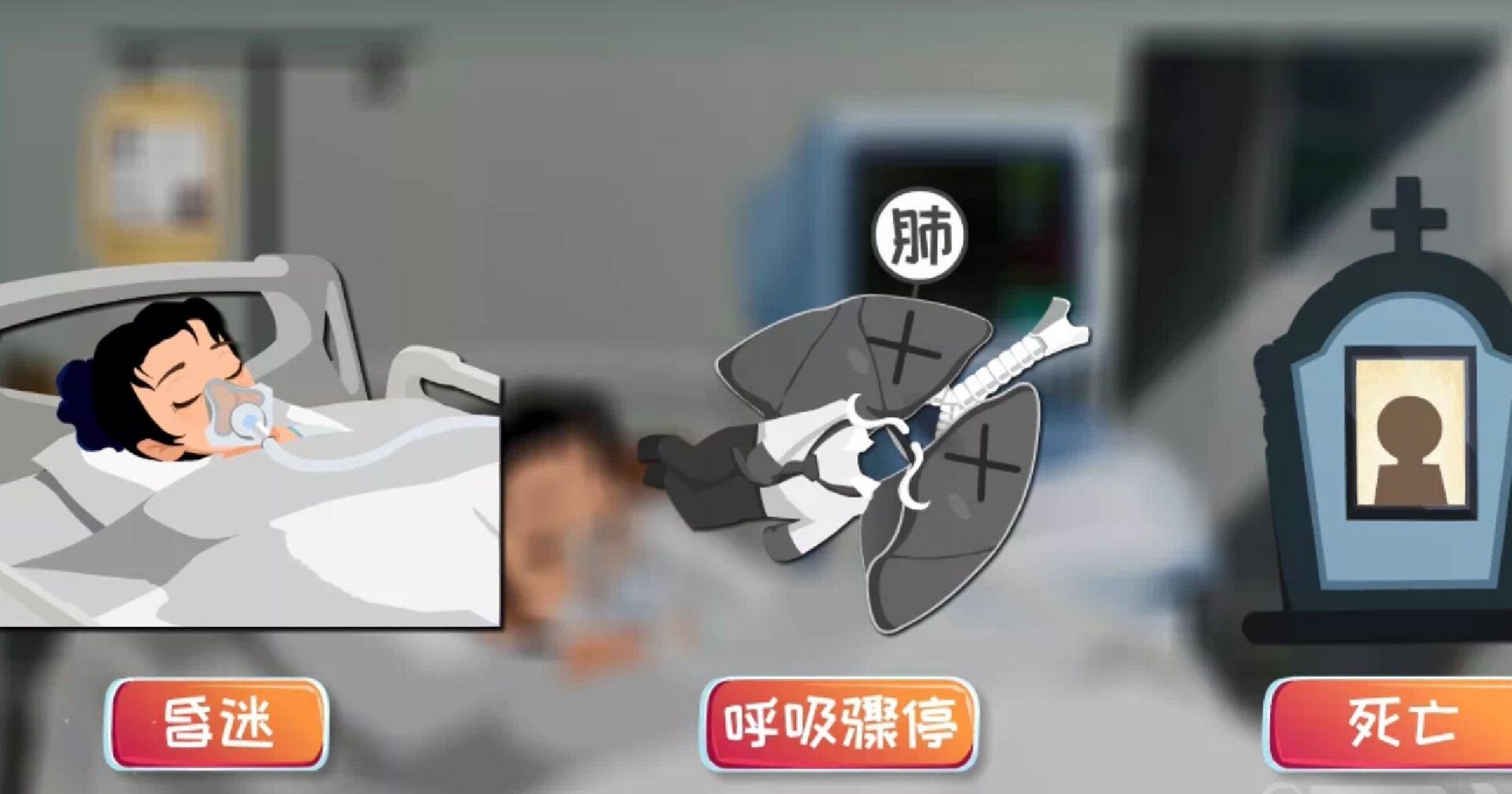 狂犬病从感染到发病死亡,会经历潜伏期,前驱期,急性神经症状期,麻痹期