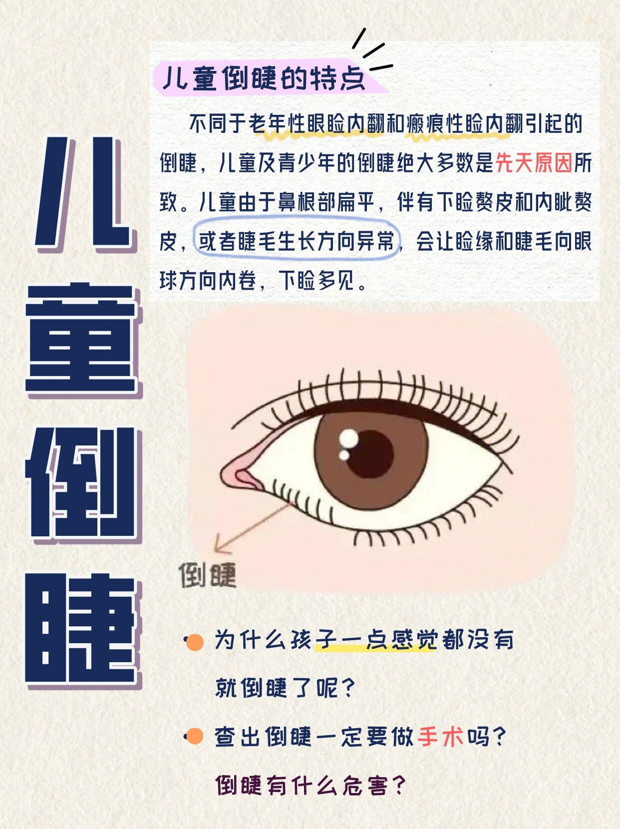 儿童倒睫是怎么回事?