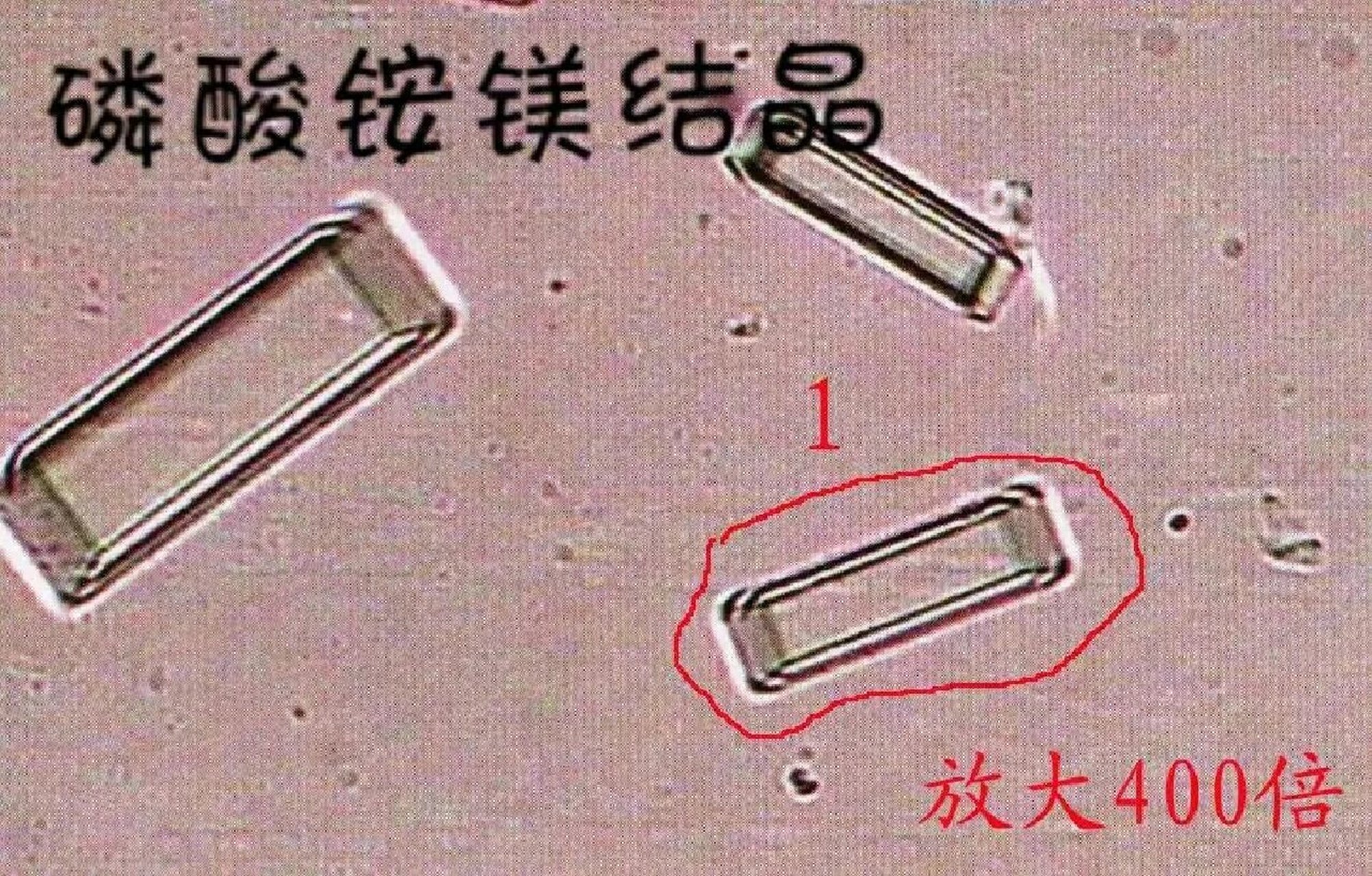 猫磷酸铵镁结晶图片图片