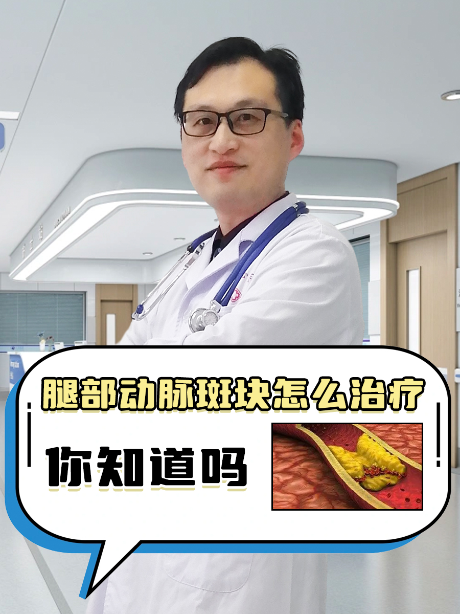 腿部动脉斑块怎么治疗,你知道吗 腿部动脉斑块的形成是由于动脉硬化