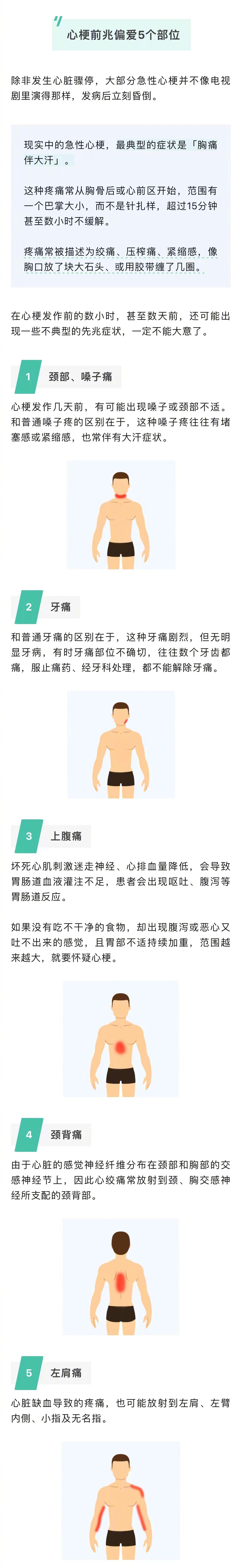 现实中心梗的典型症状是胸痛伴大汗,疼痛范围有一个巴掌大小,超过15