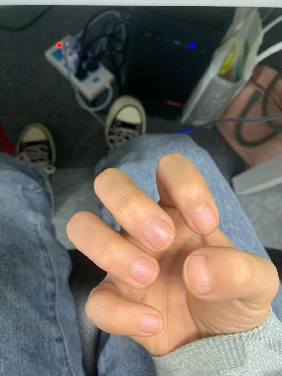 d型短指症会疯狂心动的美甲款式(二) 美甲原图无滤镜!