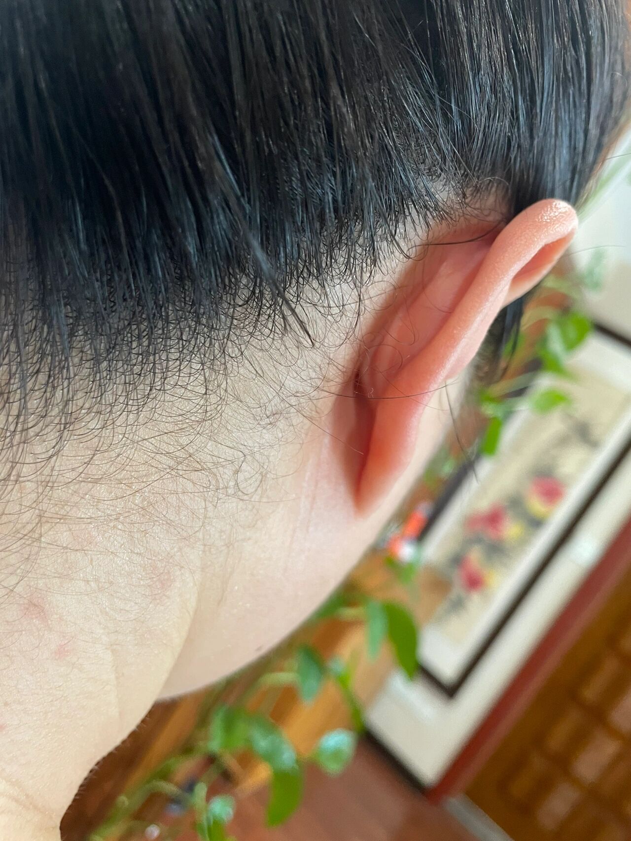 有懂医理的朋友吗帮忙看看耳后什么情况