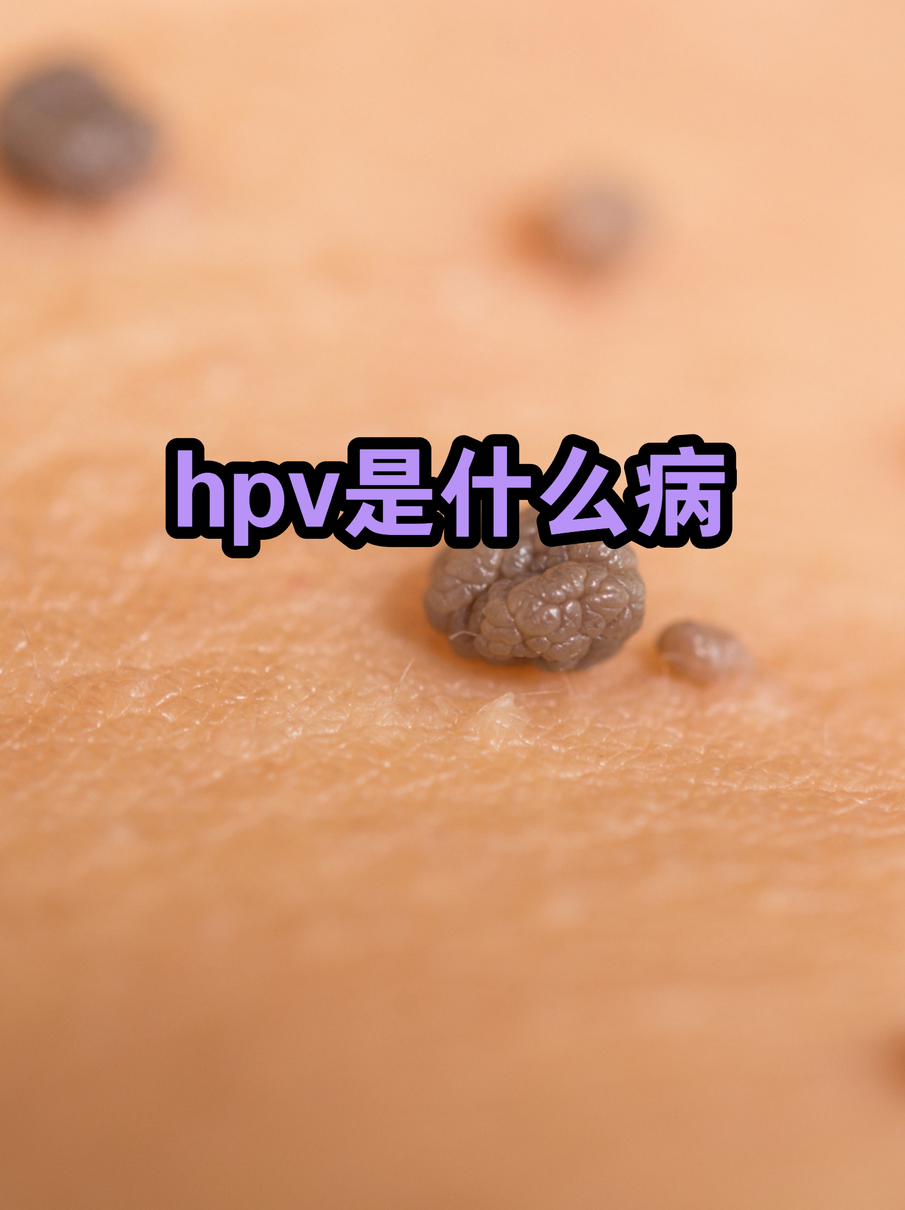  最近是不是有什么病毒感染(病毒感染一般几天能好)