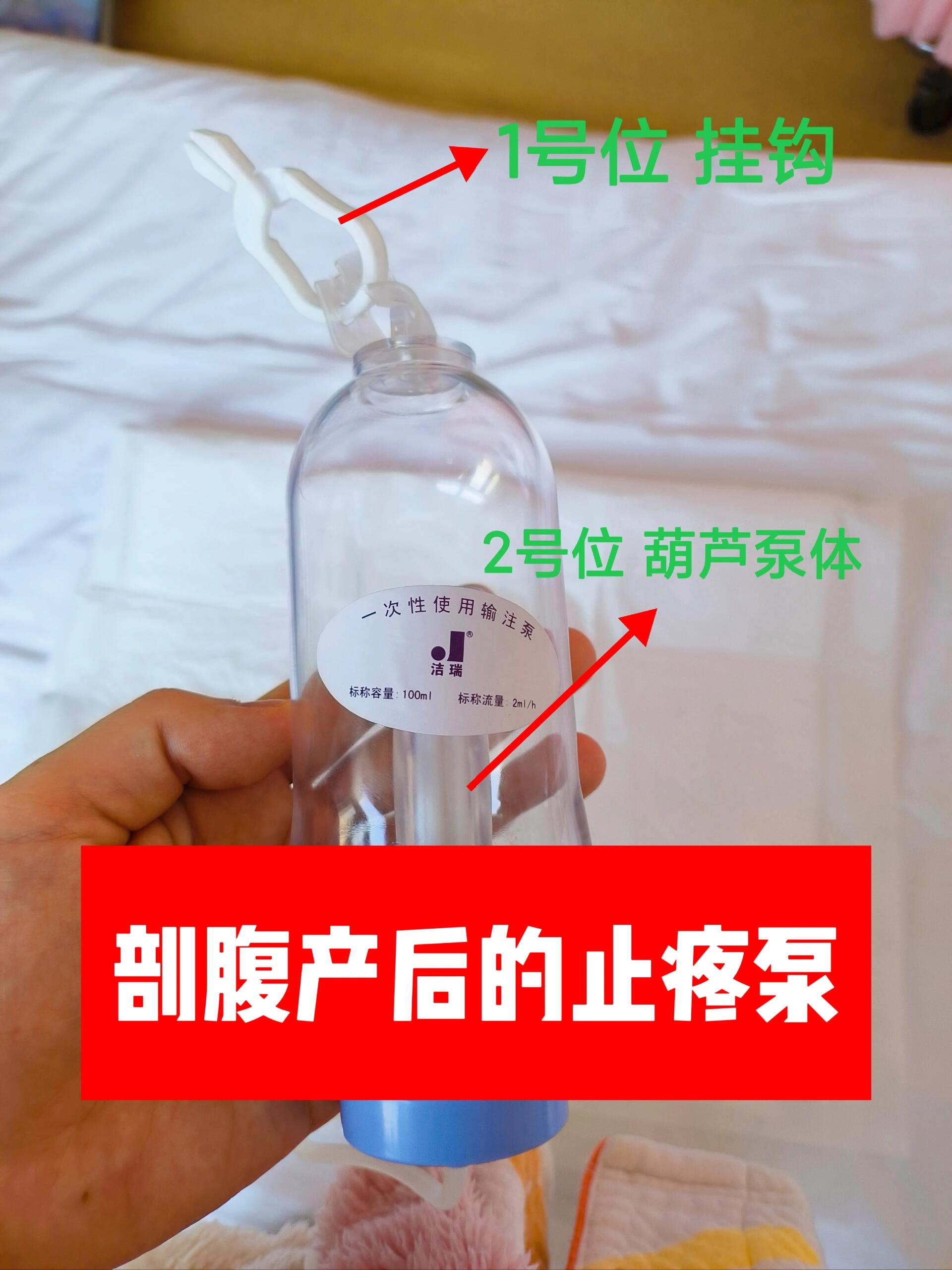 关于剖腹产后的止疼泵用法 剖腹产第二天,也就是2.