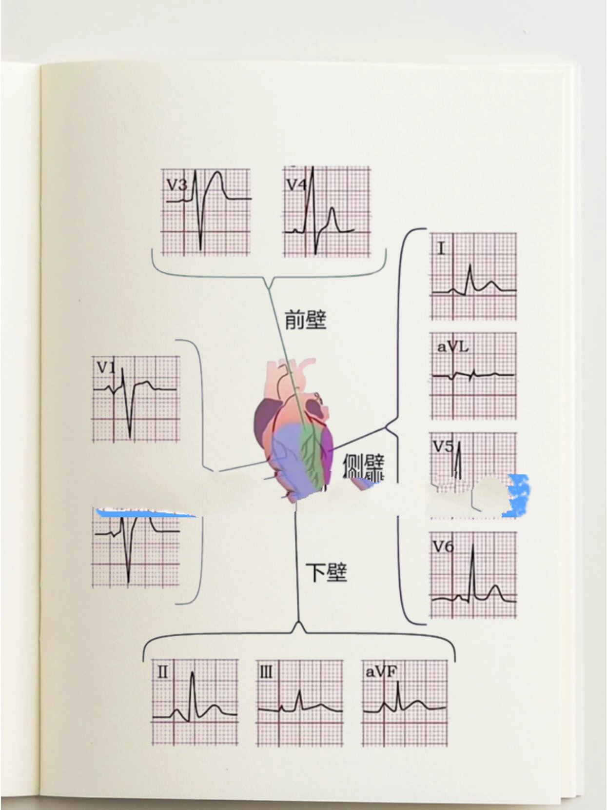现在才知道心电图导联这么简单