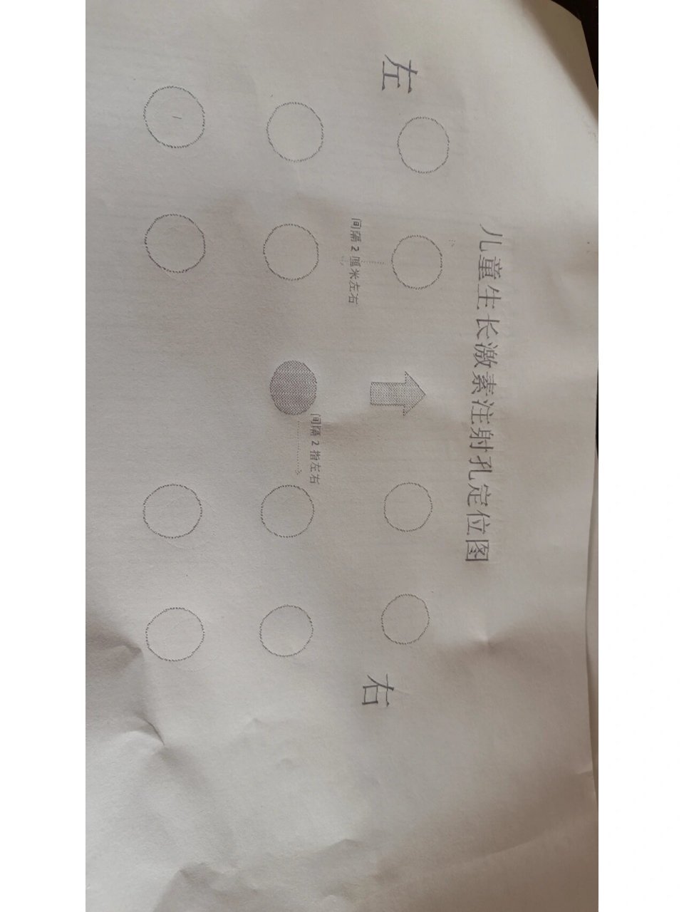 儿童生长激素注射孔定位图 由于第一次接触自己打针没有经验,手忙脚乱