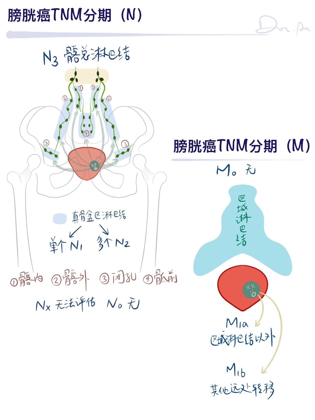 膀胱癌tnm分期标准图片