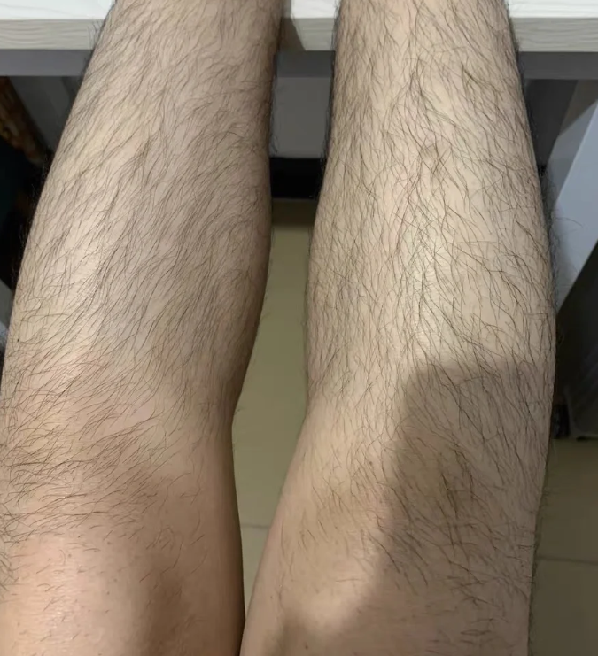 男性第二性征是什么?