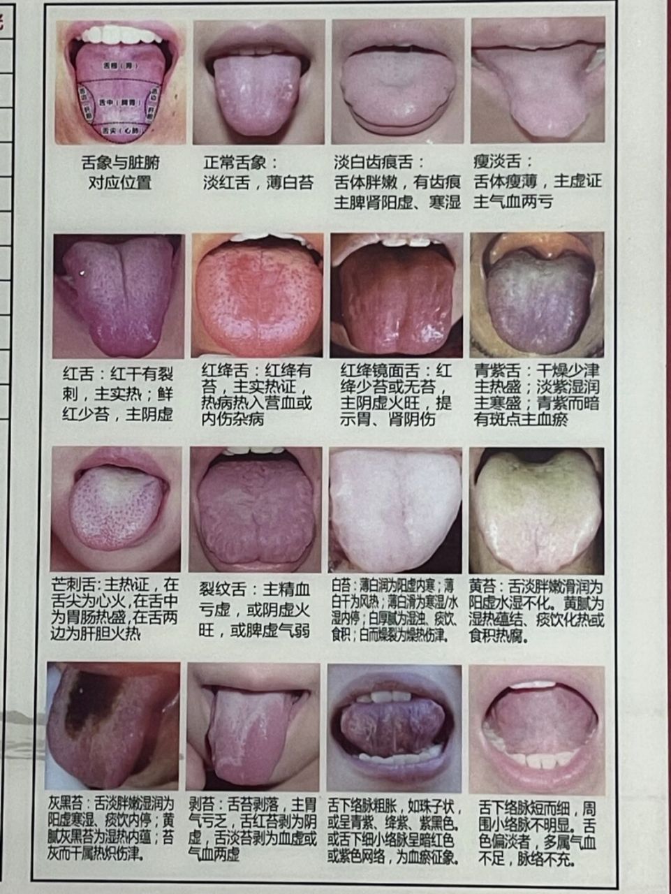 舌相病症图解图片
