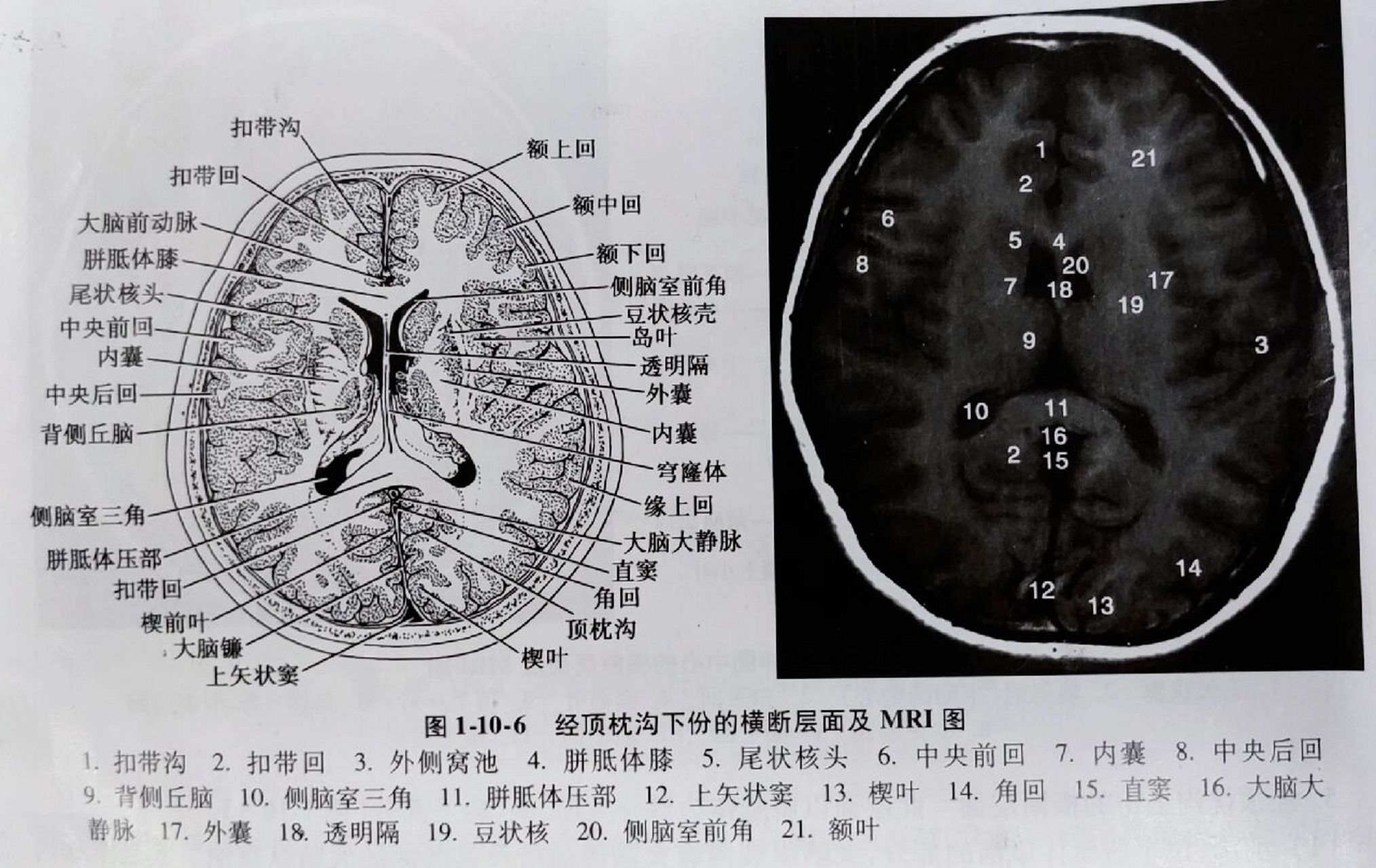 《头部的断面解剖及影像①》 1.经中央旁小叶上份的横断层面 2.